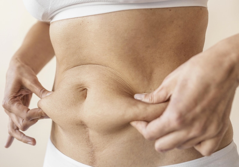 8 exercícios para fechar diástase abdominal!